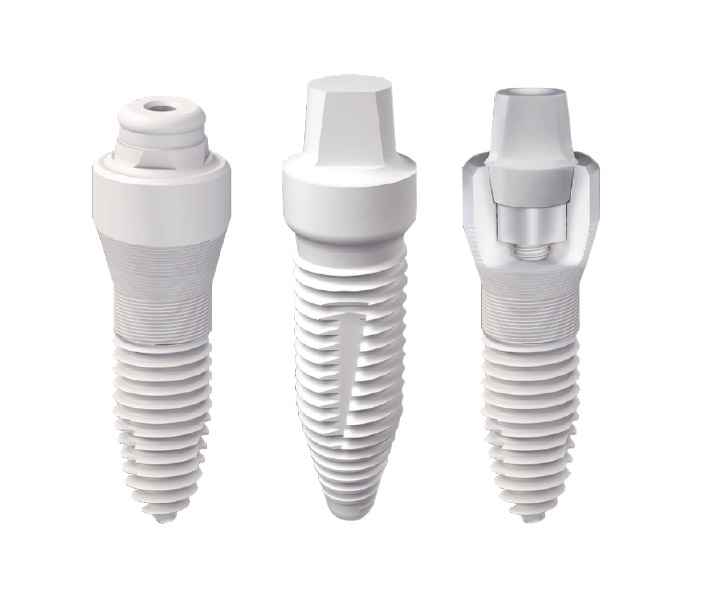 Keramikimplantate